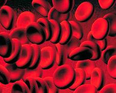 Acumulação de corpos de cetona no sangue em diabetes